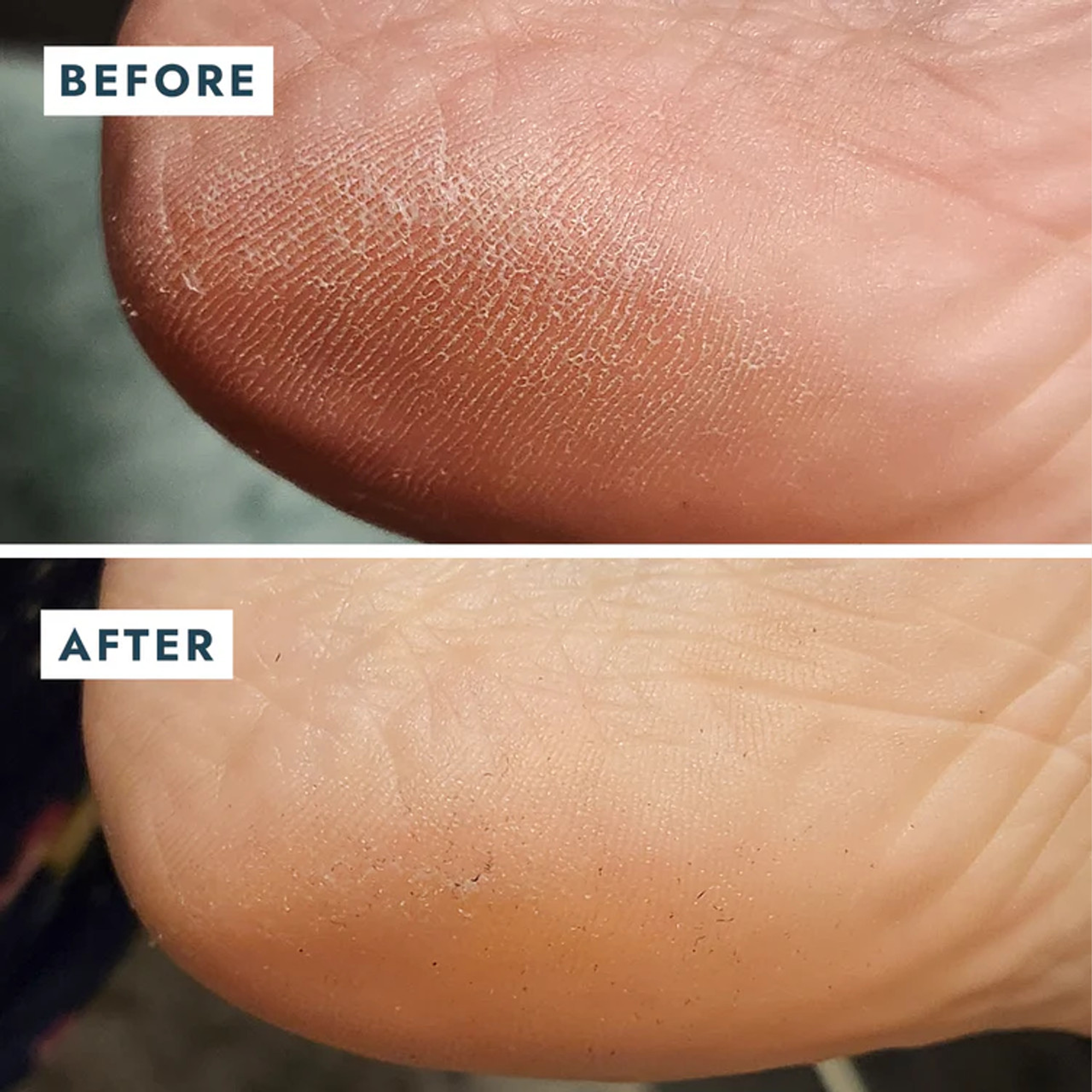 Voesh New York Solemate Topuk Onarıcı Balm 22 ml - Ayak bakımı için ideal, hızlı emilen yoğun formül.