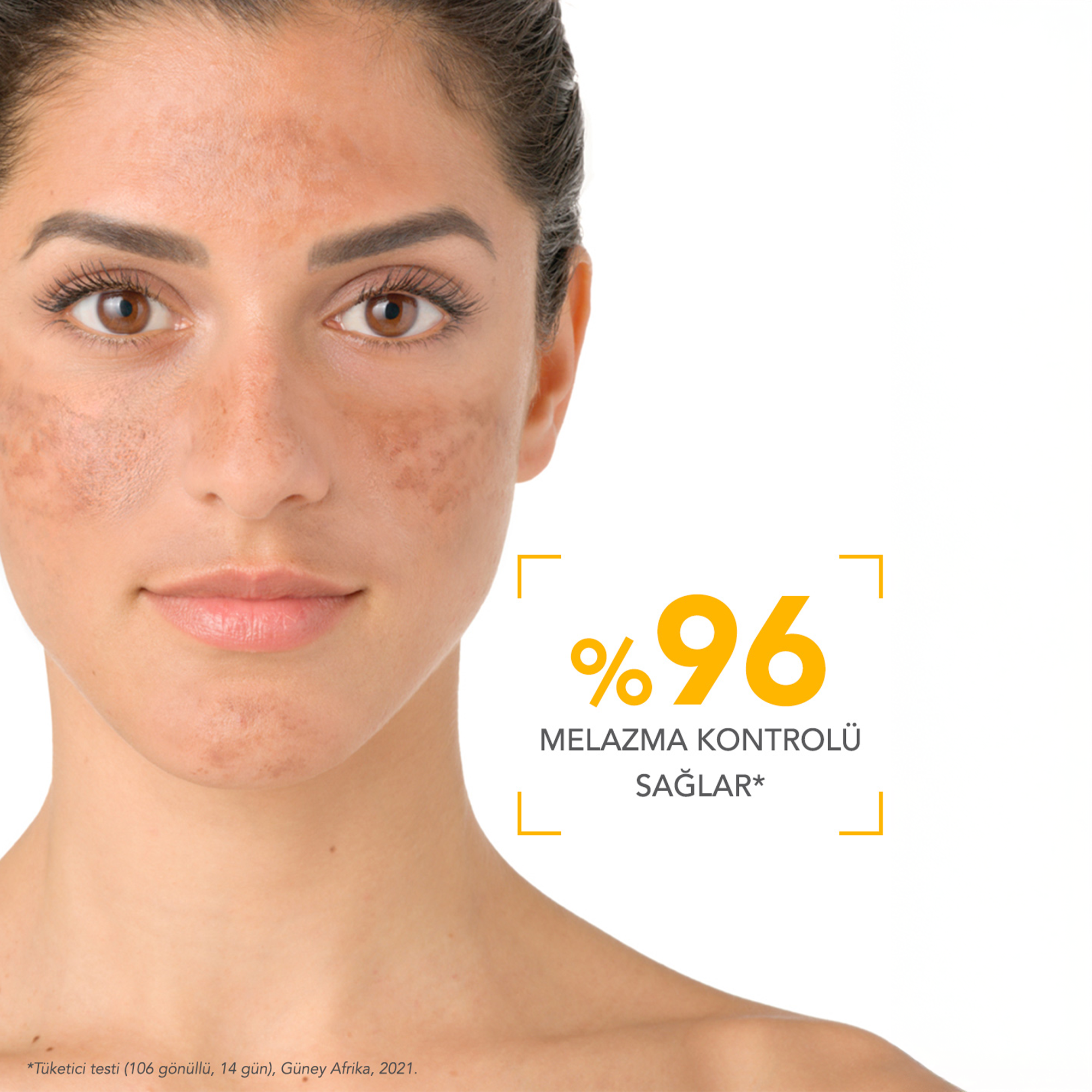 Yağlı ve karma ciltler için özel olarak formüle edilmiş Bioderma Photoderm M SPF 50+ Golden Renkli Güneş Kremi, cildi matlaştırır ve parlamayı kontrol altına alır.