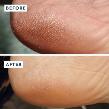 Voesh New York Solemate Topuk Onarıcı Balm 22 ml - Ayak bakımı için ideal, hızlı emilen yoğun formül.